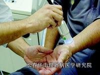 牛皮癣治疗