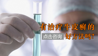 牛皮癣患者改善睡眠的方法有哪些呢