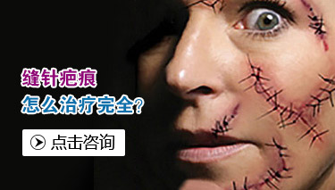 ̺ʿԸ