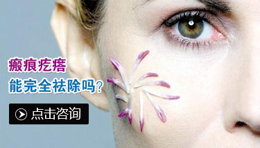 小心蚊虫叮咬引发丘疹性荨麻疹!