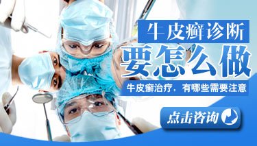 在郑州治疗牛皮癣最有经验的医院是哪家