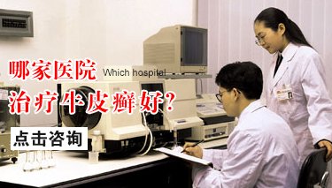 在郑州哪家医院是专业治疗牛皮癣