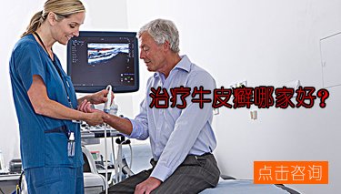 在郑州哪家医院专业治疗老人牛皮癣