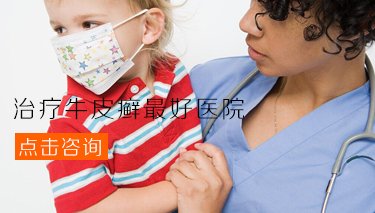 郑州哪家医院治疗儿童牛皮癣
