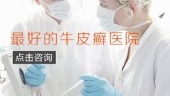 郑州牛皮癣治疗最好医院